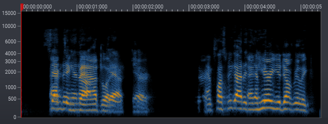 The magnitude spectrogram